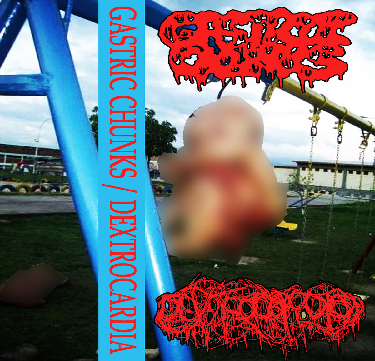 Split w/ Dextrocardia | Gastric Chunks | Gore Bubble Productions