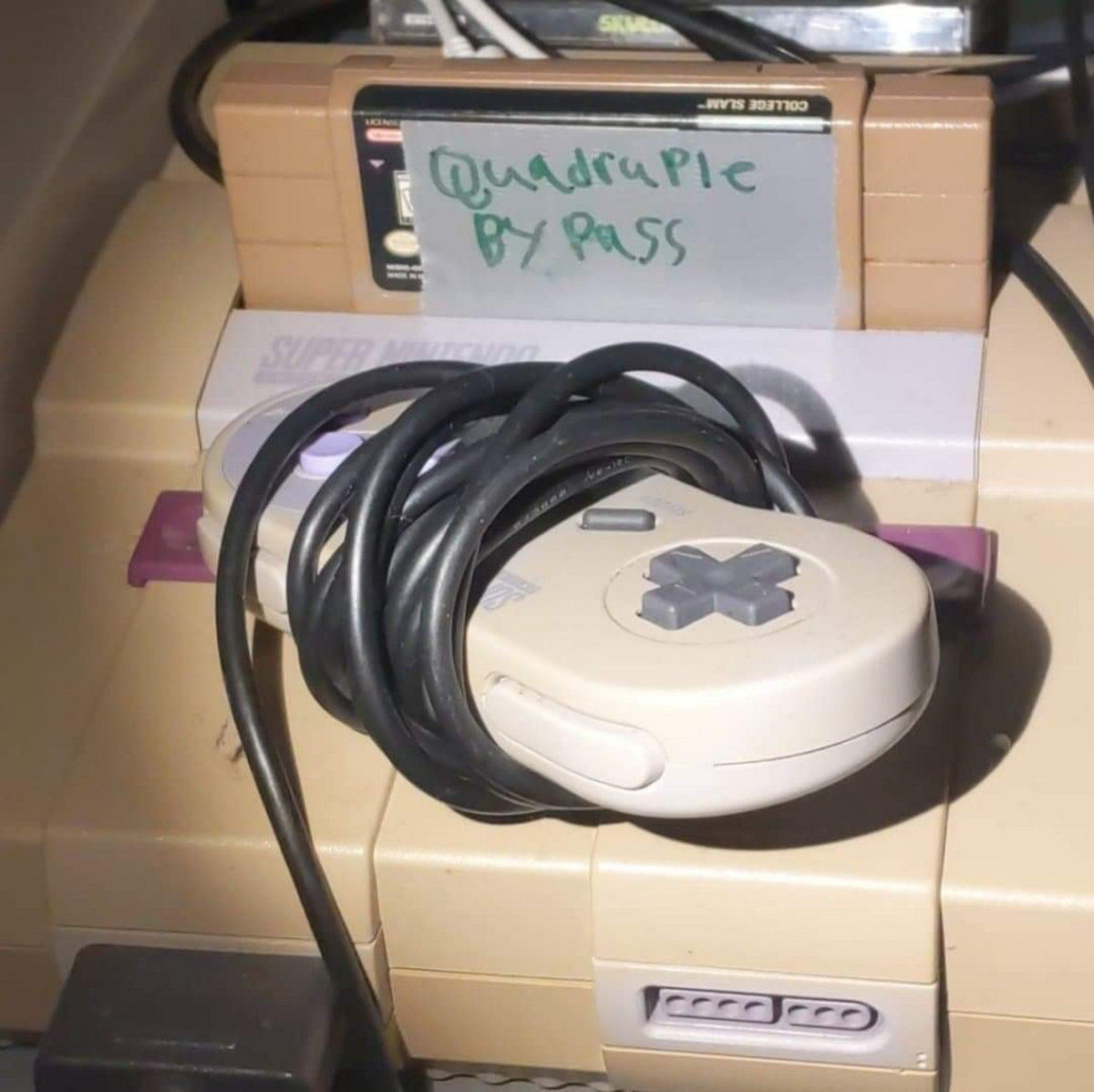 SUPER QUADRUPLE BYPASS Quadruple Bypass