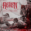 Trepanación