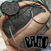 Lymphatic Rupture / Puruloid Split