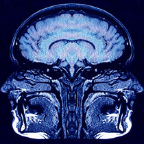 Consciousness Haze cover art