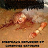 Encephalic Explosion By Gorenoise Exposure