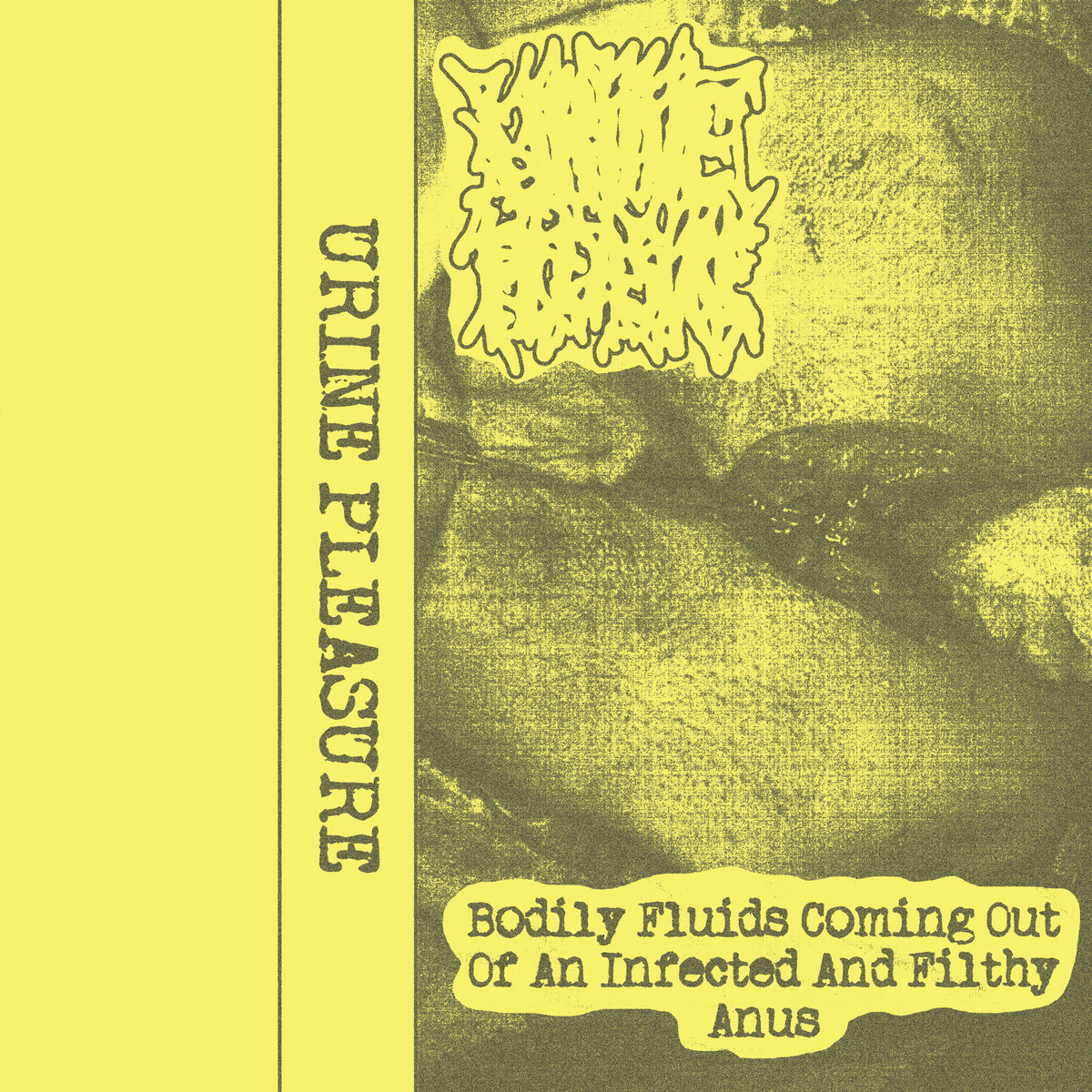 Bodily Fluids Coming Out Of An Infected And Filthy Anus Urine