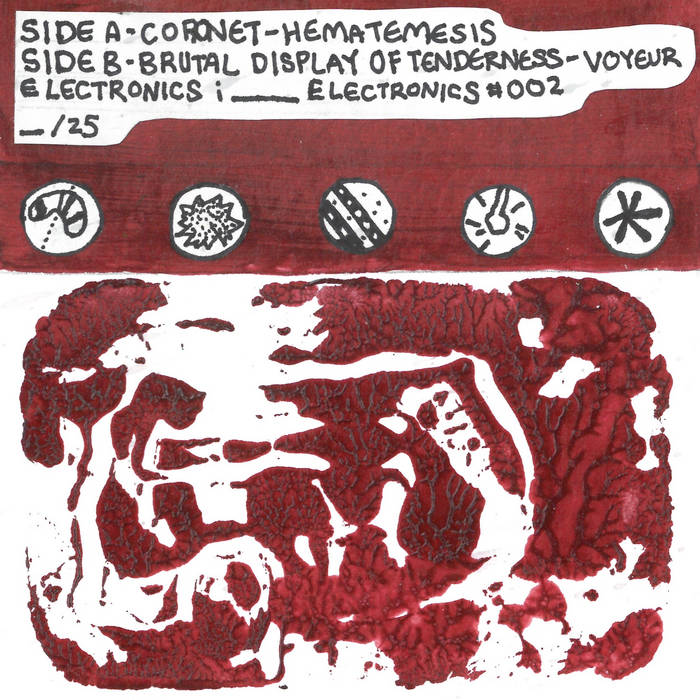 Hematemesis