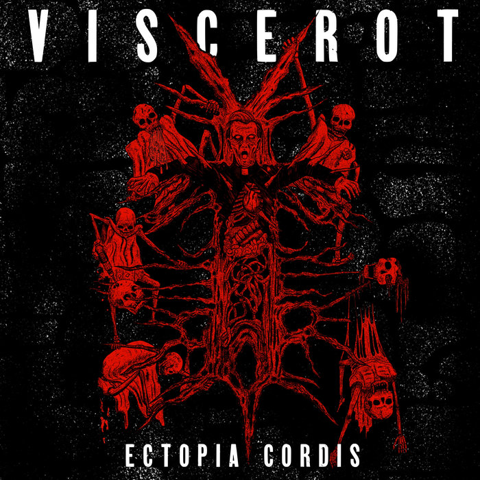 Ectopia Cordis Viscerot