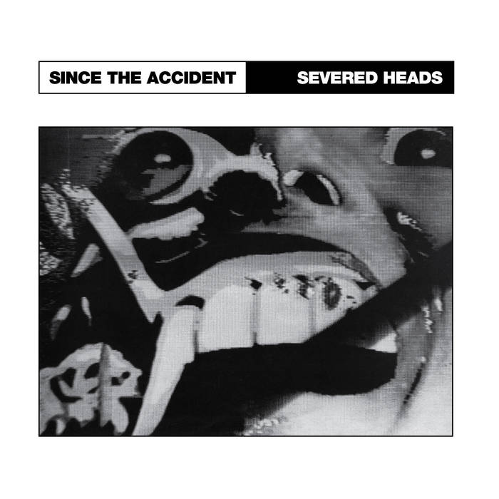 Since The Accident (MR-034) | Severed Heads | Medical Records