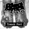 Trench Foot