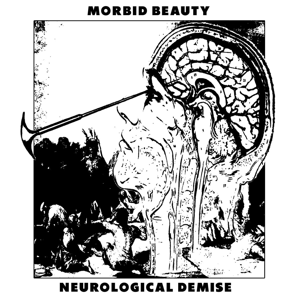 Morbid Definition Neurological Demise | Morbid Beauty