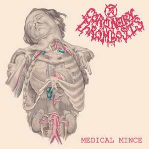 Medical Mince (teaser) cover