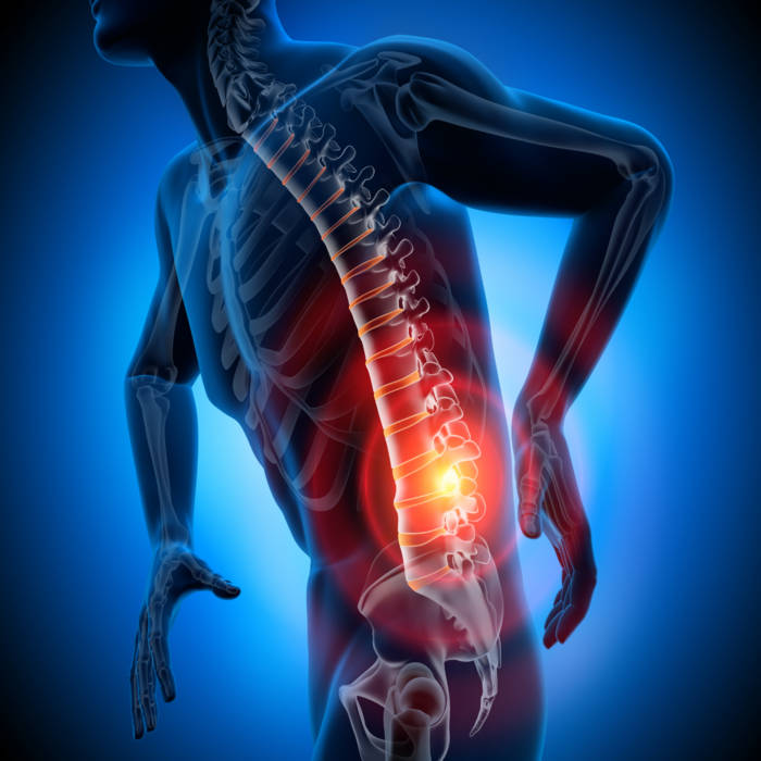 What can I take for sciatica pain?