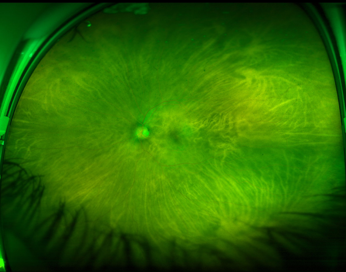 ヴァルゴ　UNDER THE WARRIOR×VIRGO ヴァルゴ UNDER THE WARRIOR×VIRGO