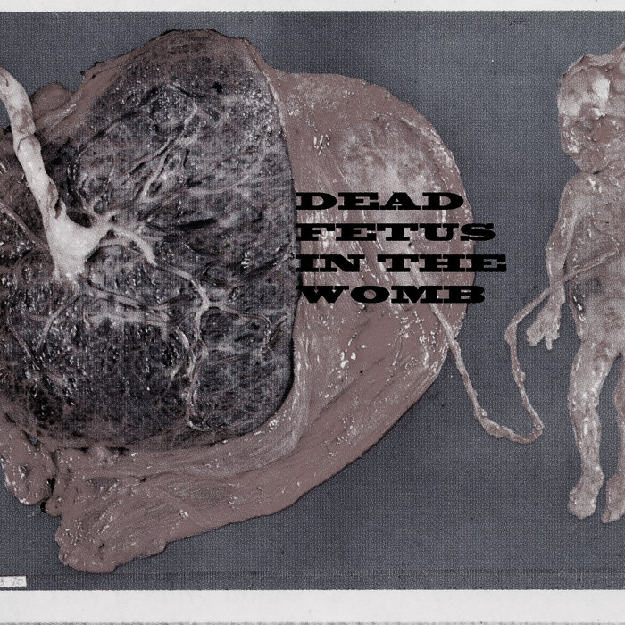 絵画 the memory in the womb a3175911070_5.jpg