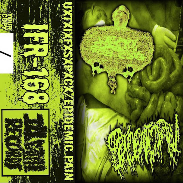 UxTxIxFxSxPxCx / Epidemic Pain (IFR-168) | Ill Faith Records