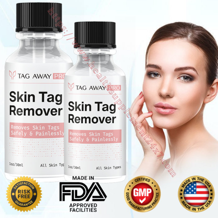 Tag Away Pro Skin Tag Remover (2024 Live SALE!!) Serum To Remove Moles