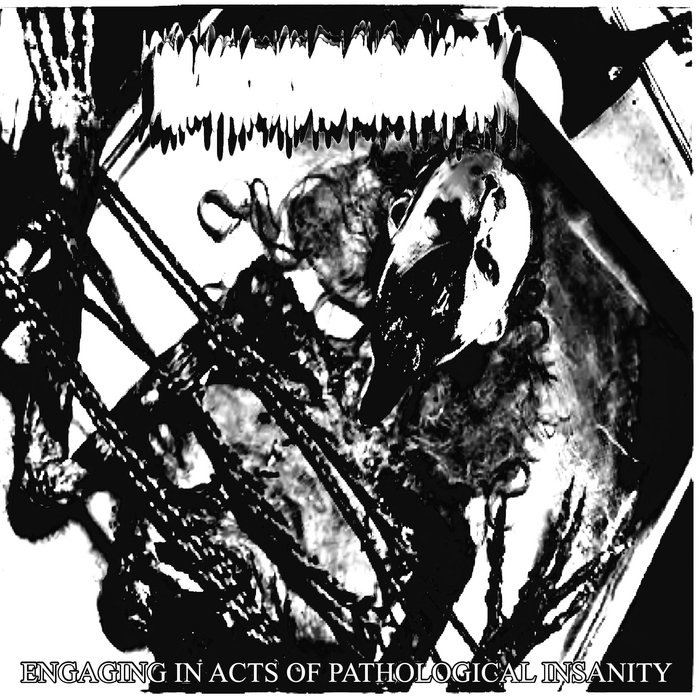 Internal Lung Bleeding from an Emphysema Infection NxLxCxRxUxExAxAxSxCxSx