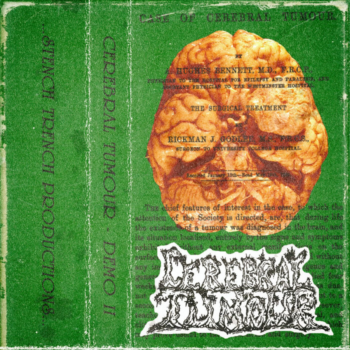 stenchtrenchprod.bandcamp.com