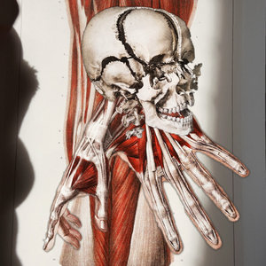Dried Up Corpse — The Surgeons Dream