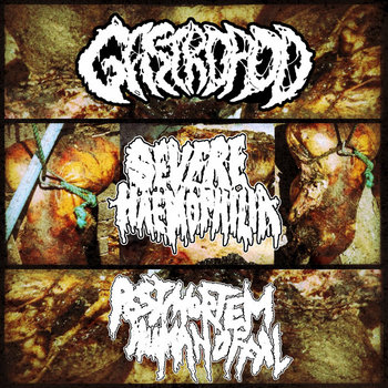 Music | Postmortem Human Offal