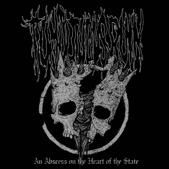 An Abscess on the Heart of the State 