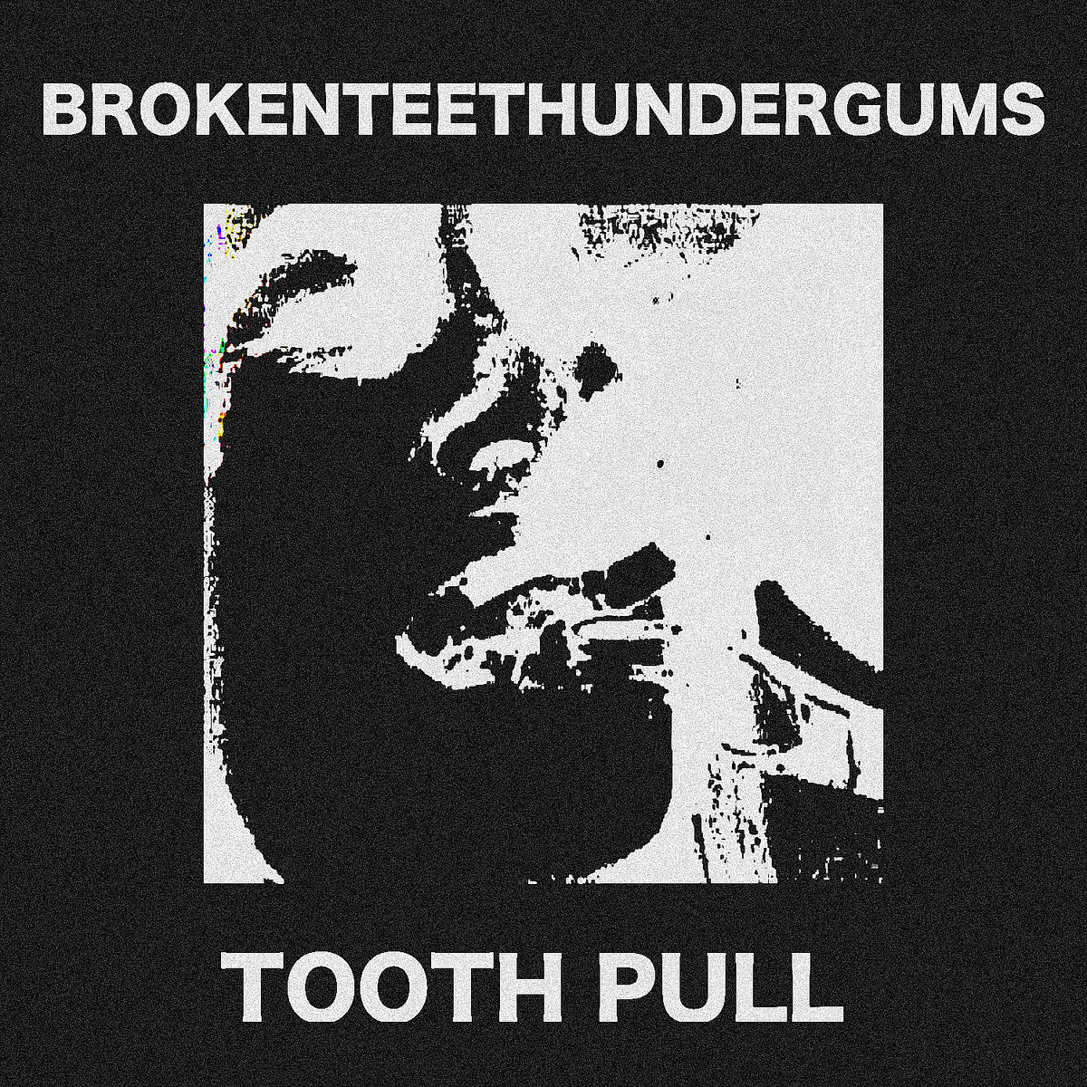 TOOTH PULL cover