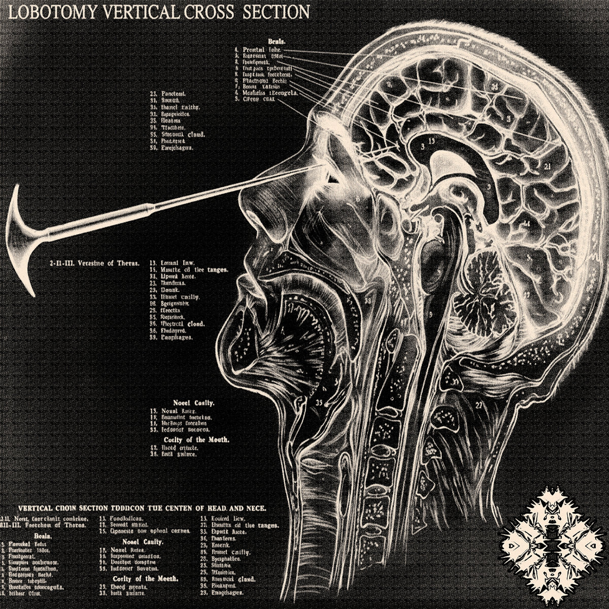 Lobotomy: Vertical Cross Section | Leucodistrofia | Javert Nihil