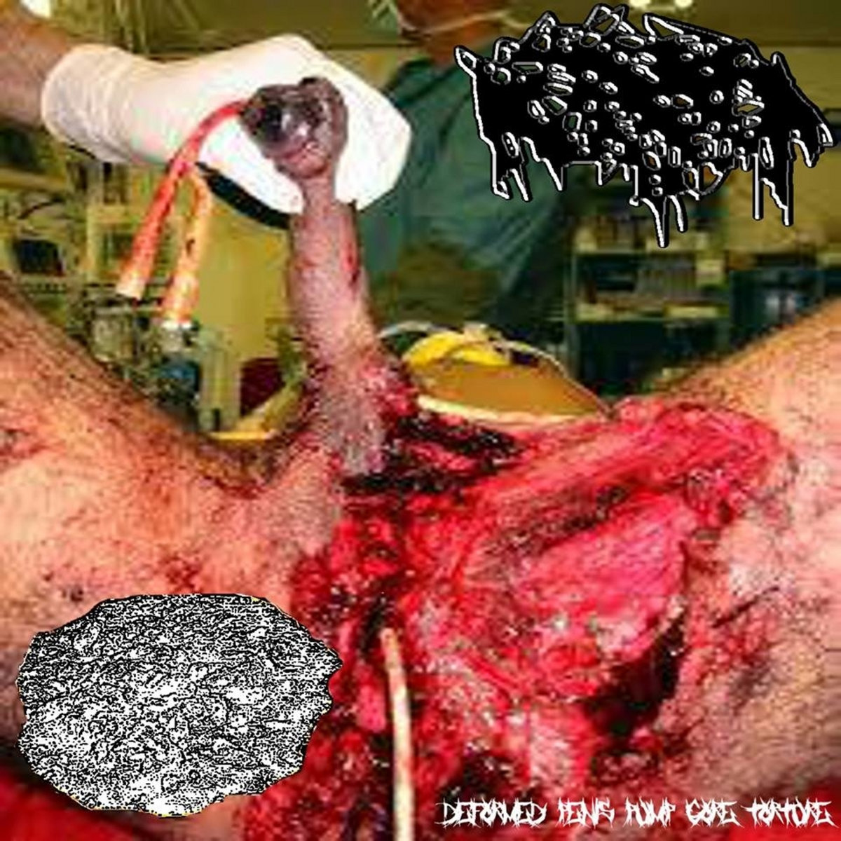 deformed penis pics Deformed penis pics