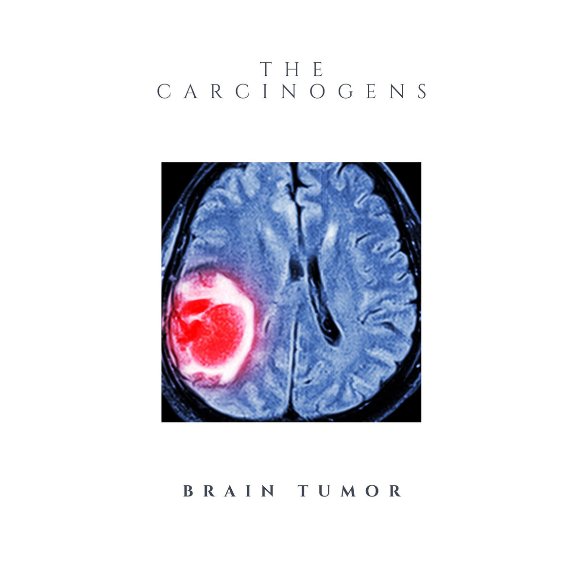 Brain Tumor The Carcinogens