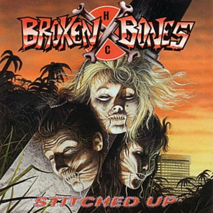 STITCHED UP | BROKEN BONES