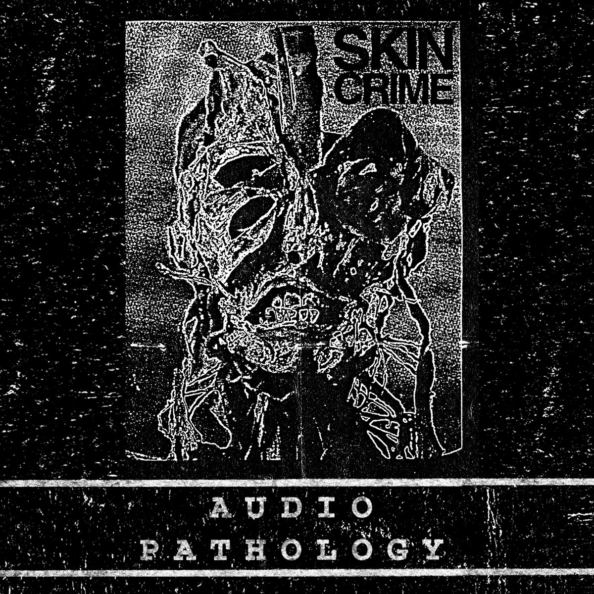アート・デザイン・音楽 Estetica del crimen crack gallery Audio Pathology | Skin Crime | Hospital Productions