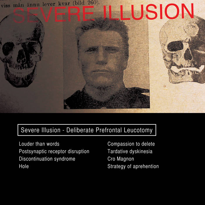 Cro Magnon | Severe Illusion | Complete Control Productions