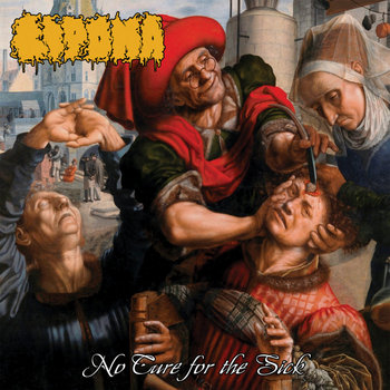 Lipoma - No Cure for the Sick