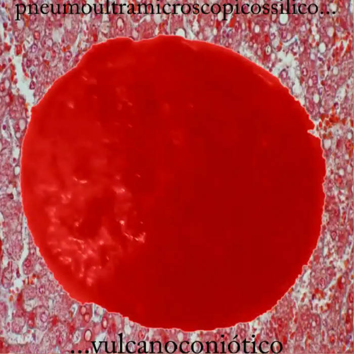 Pneumoultramicroscopicossilicovulcanoconiótico | Cardiopatiaisquemica