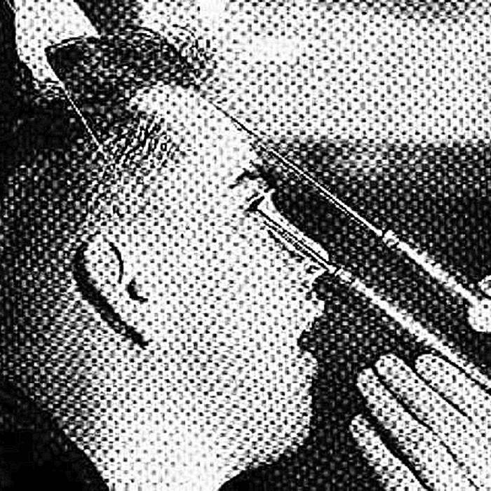 Что такое лоботомия картинки до и после