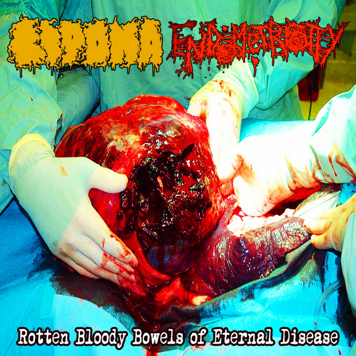 Lipoma - Rotten Bloody Bowels of Eternal Disease