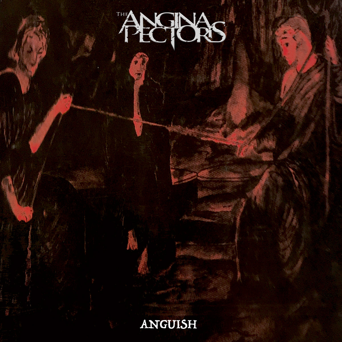 Angina Pectoris