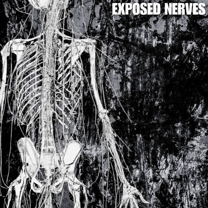 S/T | Exposed Nerves