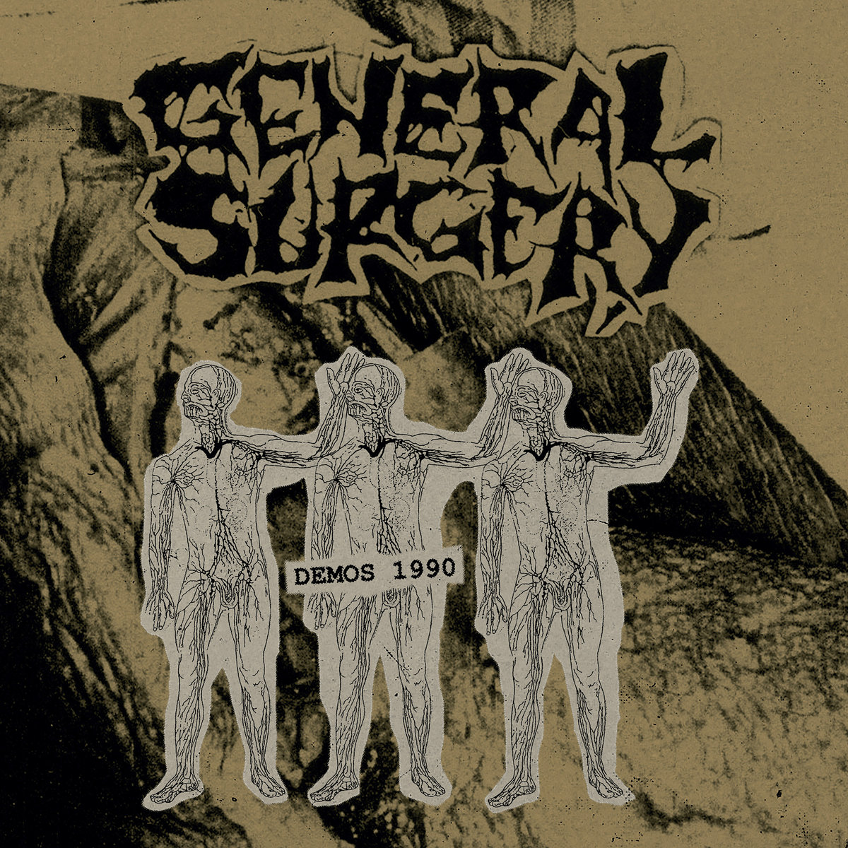 洋楽 GENERAL SURGERY Demo1990 LP F.O.A.D. Demos 1990 | General Surgery | F.O.A.D. Records