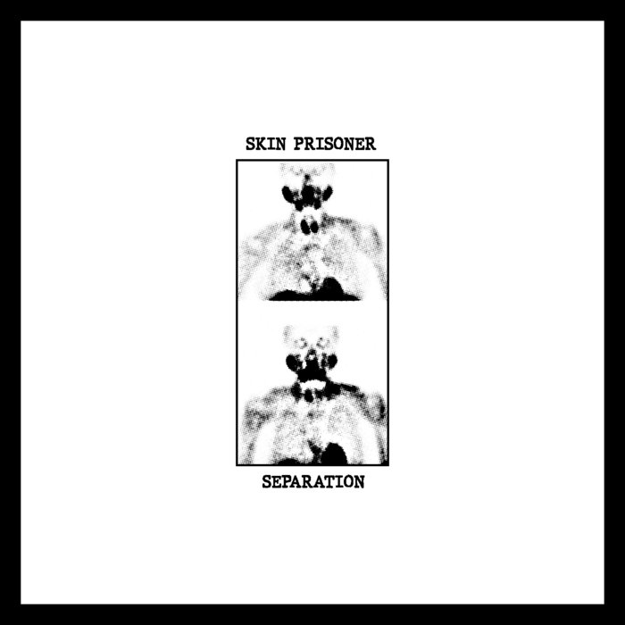 Separation skin prisoner
