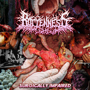 Surgically Impaired [Single] cover