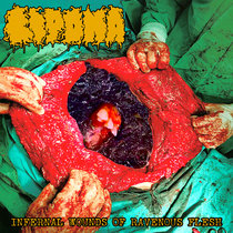 Lipoma - Infernal Wounds of Ravenous Flesh