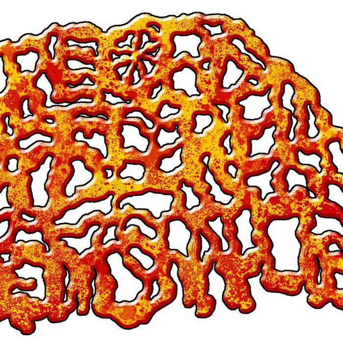 Rubber Band Ligation for Hemorrhoids Rectal Fissure Genital Herpres