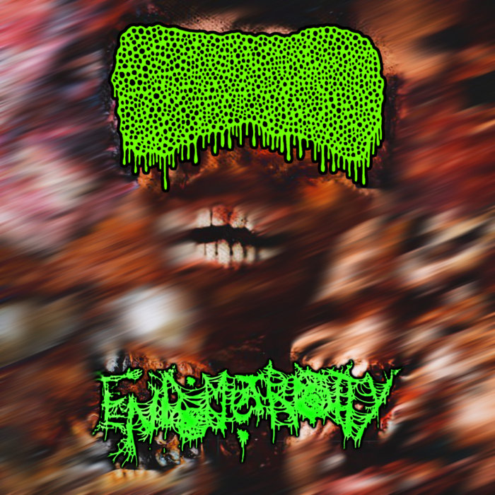 Split With Endometriosity Lymphoedema