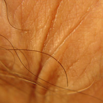 CfOC: oRSo v DL cover art