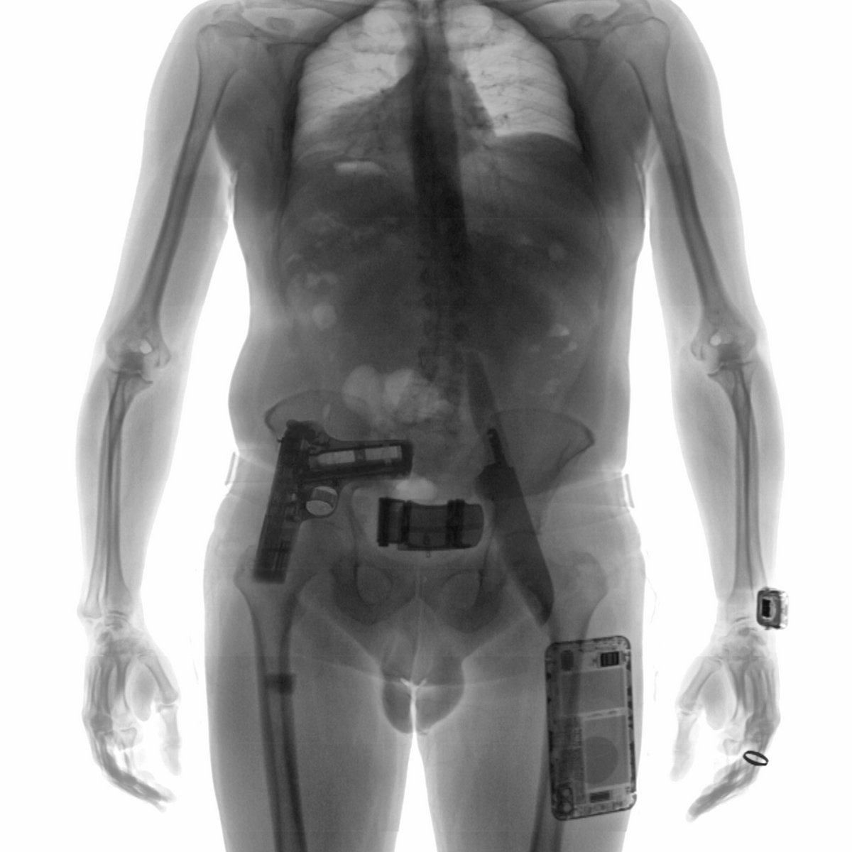 Adoni Body Scanner southside with lolina | Rabit