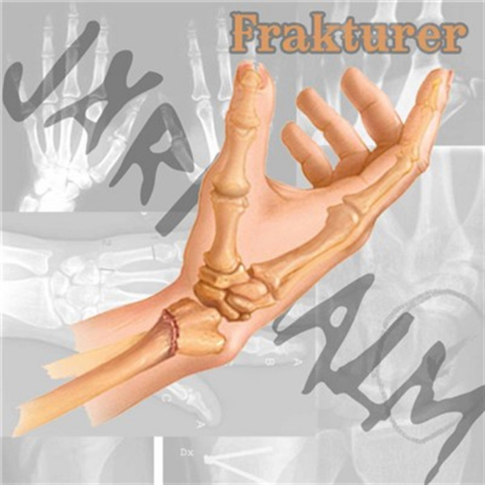 Frakturer | Järnmalm