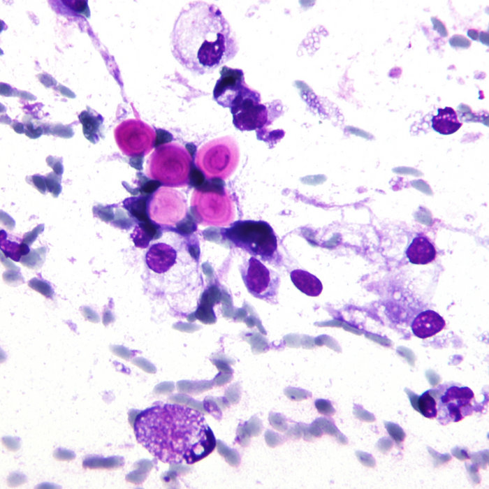 Cryptococcus | KF6GPE