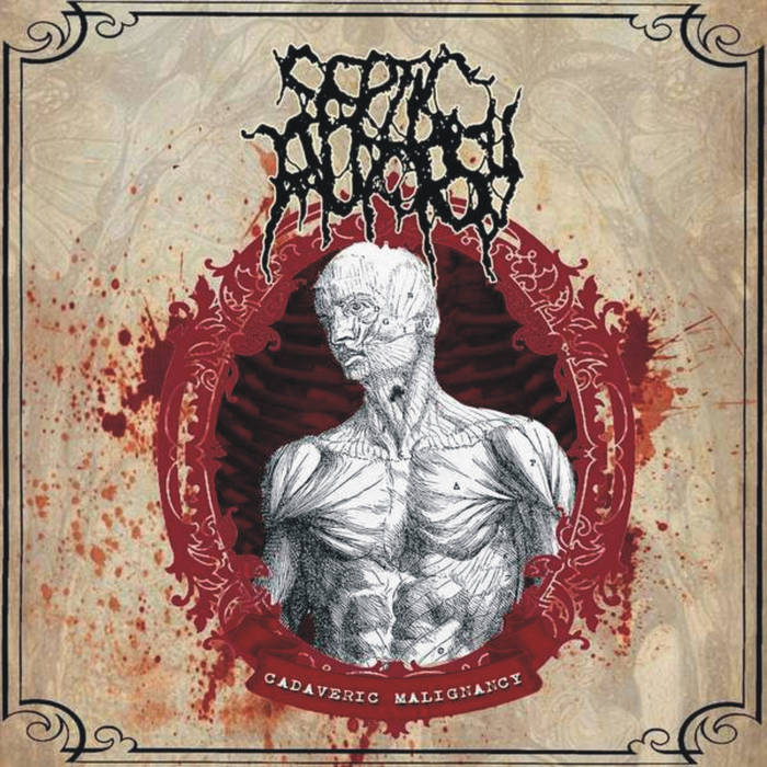 洋楽 Septic grave / caput mortuum Cadaveric Malignancy | SEPTIC AUTOPSY | Bizarre Leprous