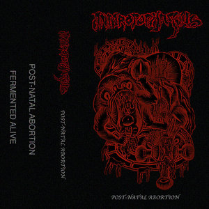 Post-Natal Abortion Demo cover