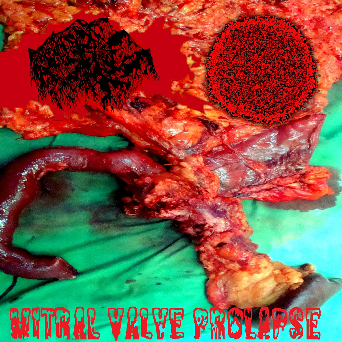 Prolapse Shit