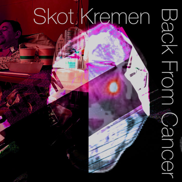 Back From Cancer Skot Kremen